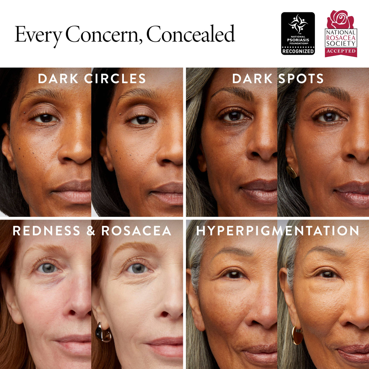 Ideal Fix Concealer: Porcelain